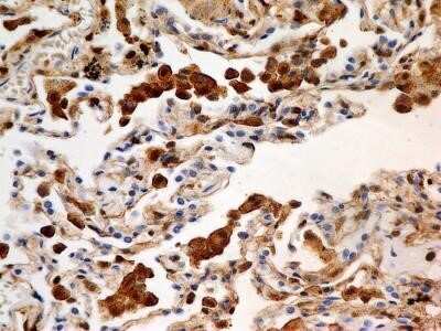 Immunohistochemistry: S100A4 Antibody (1C4) - Azide and BSA Free [NBP2-80936]
