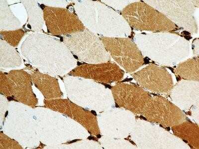 Immunohistochemistry: S100A4 Antibody (1C4) - Azide and BSA Free [NBP2-80936]