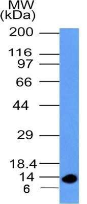 Western Blot: S100A4 Antibody (1C4)Azide and BSA Free [NBP2-80936]