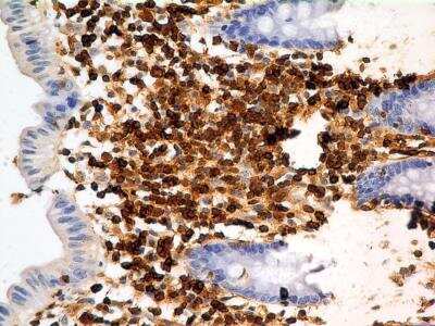 Immunohistochemistry-Paraffin: S100A4 Antibody (1C4) - BSA Free [NBP2-36431]