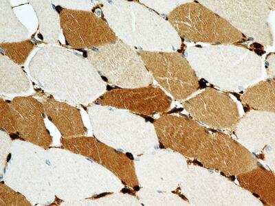 Immunohistochemistry-Paraffin: S100A4 Antibody (1C4) - BSA Free [NBP2-36431]