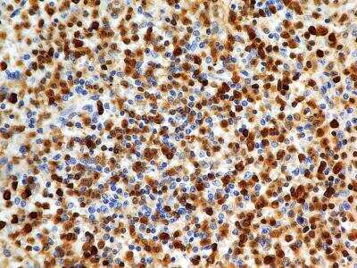 Immunohistochemistry-Paraffin: S100A4 Antibody (1C4) - BSA Free [NBP2-36431]