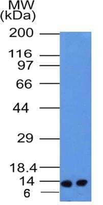 Western Blot: S100A4 Antibody (1C4)BSA Free [NBP2-36431]