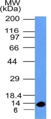 Western Blot: S100A4 Antibody (1C4)BSA Free [NBP2-36431]
