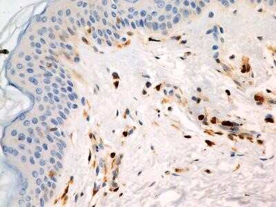 Immunohistochemistry: S100A4 Antibody (1F11) - Azide and BSA Free [NBP2-80935]