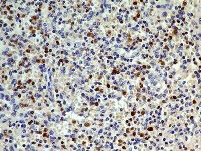 Immunohistochemistry: S100A4 Antibody (1F11) - Azide and BSA Free [NBP2-80935]