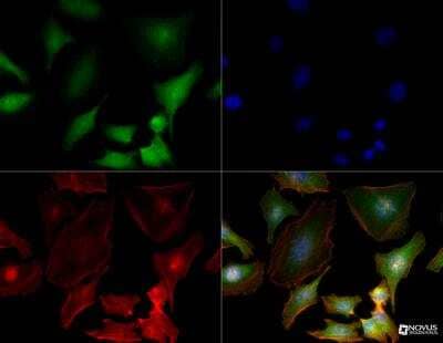 Immunocytochemistry/ Immunofluorescence: S100A4 Antibody (1F11) - BSA Free [NBP2-36430]