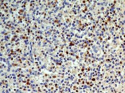 Immunohistochemistry-Paraffin: S100A4 Antibody (1F11) - BSA Free [NBP2-36430]