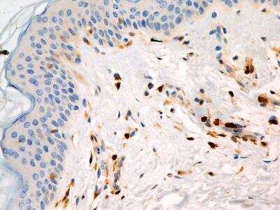 Immunohistochemistry-Paraffin: S100A4 Antibody (1F11) - BSA Free [NBP2-36430]