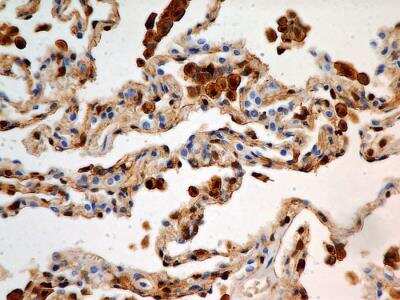 Immunohistochemistry-Paraffin: S100A4 Antibody (1F11) - BSA Free [NBP2-36430]
