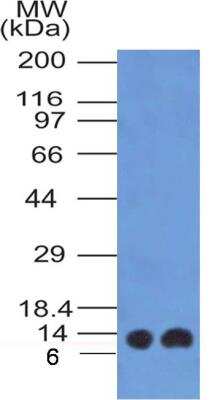 Western Blot: S100A4 Antibody (1F11)BSA Free [NBP2-36430]