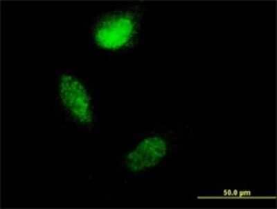 Immunocytochemistry/ Immunofluorescence: S100A4 Antibody (1F12-1G7) [H00006275-M01]