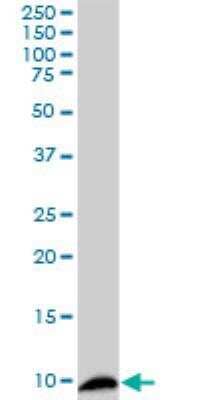 Western Blot: S100A4 Antibody (1F12-1G7) [H00006275-M01]