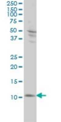 Western Blot: S100A4 Antibody (1F12-1G7) [H00006275-M01]