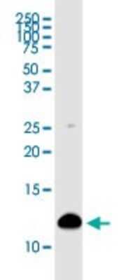 Western Blot: S100A4 Antibody (1F12-1G7) [H00006275-M01]