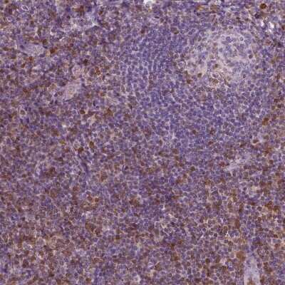 Immunohistochemistry-Paraffin: S100A4 Antibody (CL0237) [NBP2-52890]