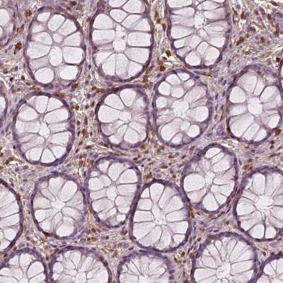 Immunohistochemistry-Paraffin: S100A4 Antibody (CL0237) [NBP2-52890]