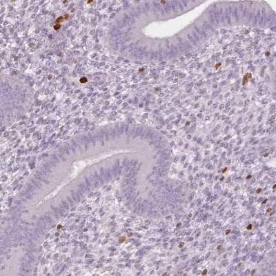 Immunohistochemistry-Paraffin: S100A4 Antibody (CL0237) [NBP2-52890]