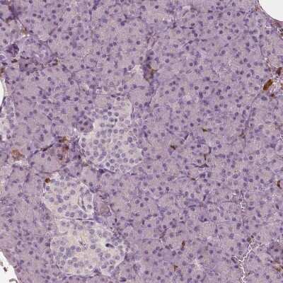 Immunohistochemistry-Paraffin: S100A4 Antibody (CL0237) [NBP2-52890]