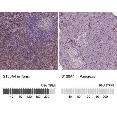 Immunohistochemistry-Paraffin: S100A4 Antibody (CL0237) [NBP2-52890]