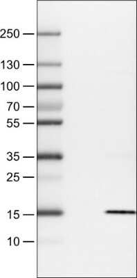 Western Blot: S100A4 Antibody (CL0237) [NBP2-52890]
