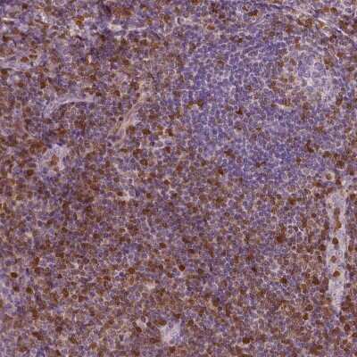 Immunohistochemistry-Paraffin: S100A4 Antibody (CL0239) [NBP2-52891]