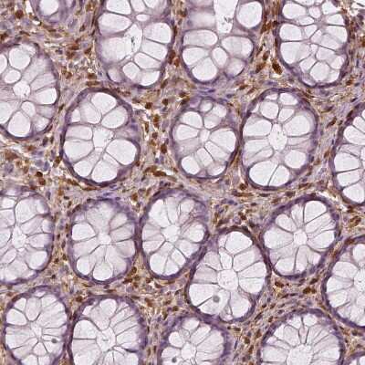 Immunohistochemistry-Paraffin: S100A4 Antibody (CL0239) [NBP2-52891]