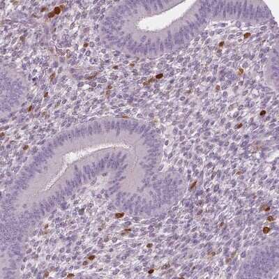 Immunohistochemistry-Paraffin: S100A4 Antibody (CL0239) [NBP2-52891]