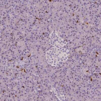 Immunohistochemistry-Paraffin: S100A4 Antibody (CL0239) [NBP2-52891]