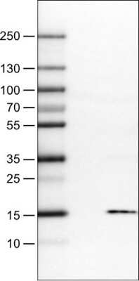Western Blot: S100A4 Antibody (CL0239) [NBP2-52891]