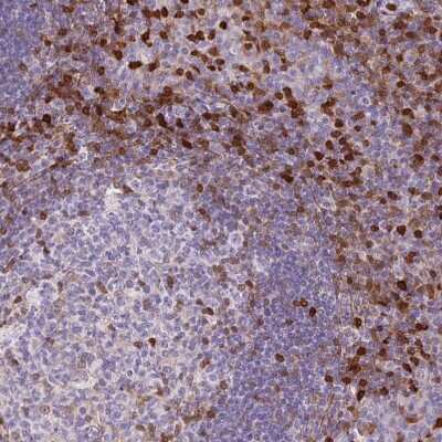 Immunohistochemistry-Paraffin: S100A4 Antibody (CL0240) [NBP2-52892]