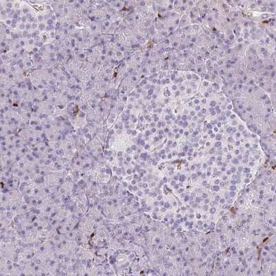 Immunohistochemistry-Paraffin: S100A4 Antibody (CL0240) [NBP2-52892]