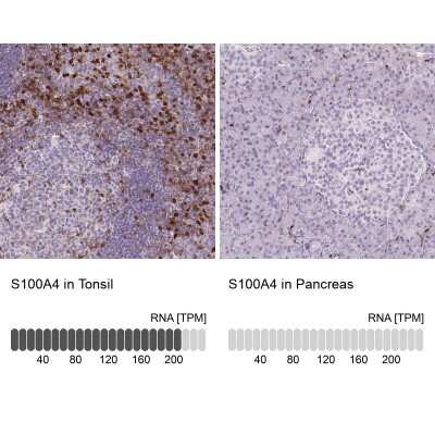 Immunohistochemistry-Paraffin: S100A4 Antibody (CL0240) [NBP2-52892]