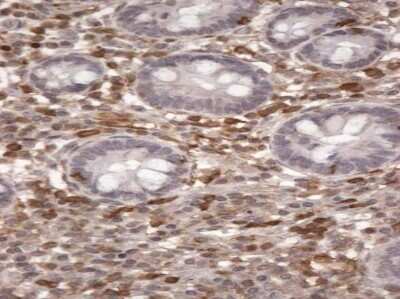 Immunohistochemistry-Paraffin: S100A4 Antibody [NB100-55404]