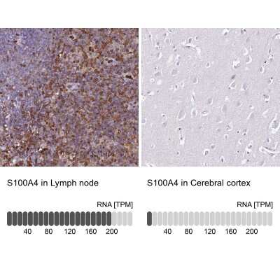 Immunohistochemistry-Paraffin: S100A4 Antibody [NBP1-89402]