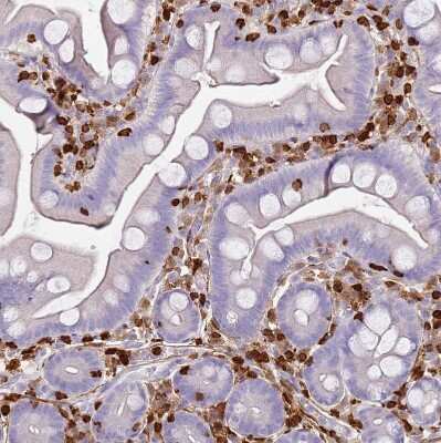 Immunohistochemistry-Paraffin: S100A4 Antibody [NBP1-89402]