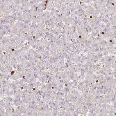 Immunohistochemistry-Paraffin: S100A4 Antibody [NBP1-89402]