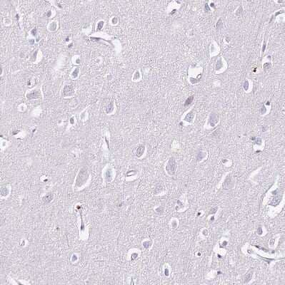 Immunohistochemistry-Paraffin: S100A4 Antibody [NBP1-89402]