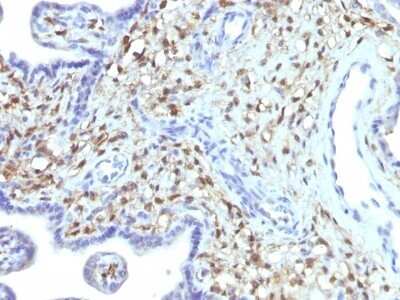 Immunohistochemistry-Paraffin: S100A4 Antibody (S100A4/1481) - Azide and BSA Free [NBP2-54580]