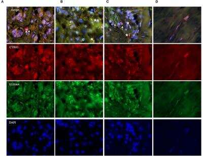 Immunohistochemistry: S100A4 Antibody (S100A4/1481) [NBP2-53178]