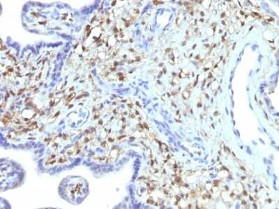 Immunohistochemistry-Paraffin: S100A4 Antibody (S100A4/1481) [NBP2-53178]
