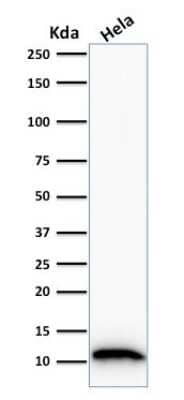 Western Blot: S100A4 Antibody (S100A4/1481) [NBP2-53178]