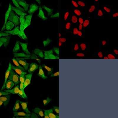 Immunocytochemistry/ Immunofluorescence: S100A4 Antibody (S100A4/1482) - Azide and BSA Free [NBP2-54400]