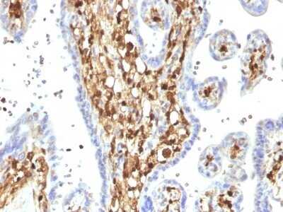 Immunohistochemistry-Paraffin: S100A4 Antibody (S100A4/1482) - Azide and BSA Free [NBP2-54400]