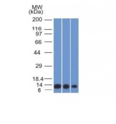 Western Blot: S100A4 Antibody (S100A4/1482)Azide and BSA Free [NBP2-54400]