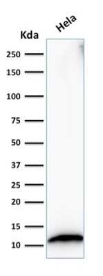 Western Blot: S100A4 Antibody (S100A4/1482) [NBP2-53270]