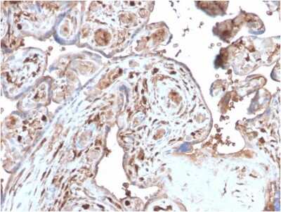 Immunohistochemistry-Paraffin: S100A4 Antibody (S100A4/2750R) - Azide and BSA Free [NBP3-08460]