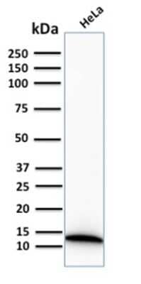 Western Blot: S100A4 Antibody (S100A4/2750R)Azide and BSA Free [NBP3-08460]
