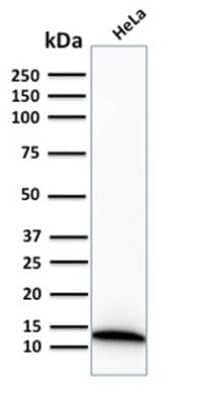 Western Blot: S100A4 Antibody (S100A4/2750R) [NBP3-07587]