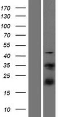 Western Blot: S100A4 Overexpression Lysate [NBP2-09893]